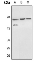 WB - Anti-Histone Deacetylase 1 (pS421) Antibody AP59578